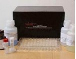 Rabbit cyanocobalamin (Vitamin B12) ELISA kit