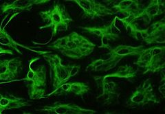 Astrocytes