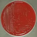 Enterococcus faecium