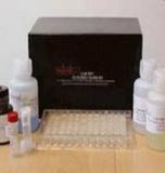 GCK ELISA Kit