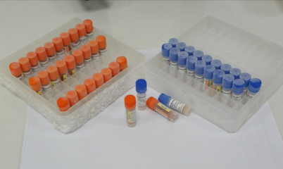 Human FASLG antibody ELISA kit