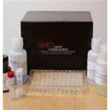 Human lumican ELISA Kit