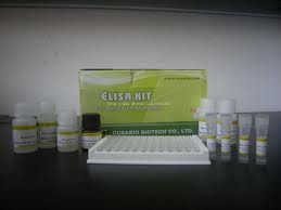 Human sRAGE ELISA kit