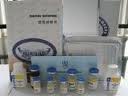 Human vimentin,VIM ELISA Kit