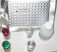 IRF ELISA Kit