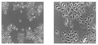 Keratinocyte Medium