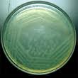 Pseudomonas Isolation Agar