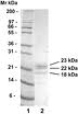 Recombinant Human IL-17B CF