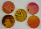 Salmonella Shigella Agar (SS Agar)